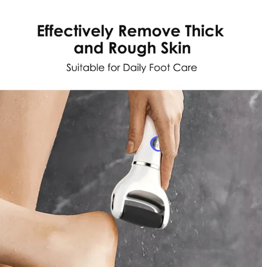 SmoothFeet Electric Exfoliator