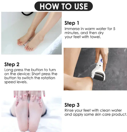 SmoothFeet Electric Exfoliator